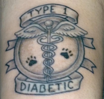 A Different Kind of CGM