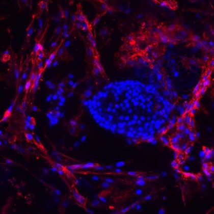 Stemming the Tide of Immune Response