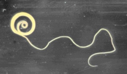 The Hygiene Hypothesis:  Too Clean for Our Own Good?