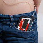 UK lagging behind Europe for use of insulin pumps