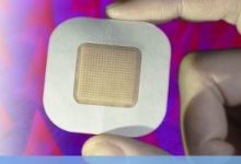 Researchers were able to preload enough insulin into the coin-sized adhesive microneedle patches to enable clinical use. [Image courtesy of UCLA]