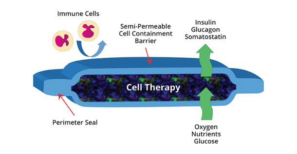 Will ViaCyte’s Encaptra Cell Delivery System ‘Cure’ Type 1 Diabetes?