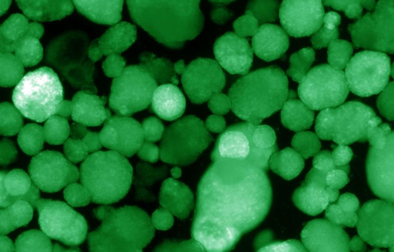 Human islet-like organoids express insulin, which is indicated by the green color.