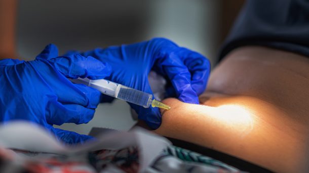 Subcutaneous Islet Transplant Provides Safer, Efficient Path for Type 1 Cure